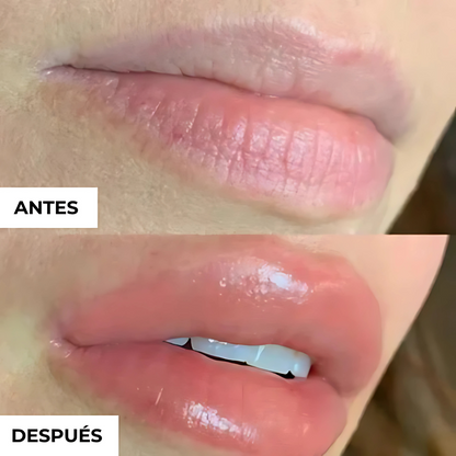 Labial Voluminizador LipsEterna [Hoy Lleva 2 Por 1]