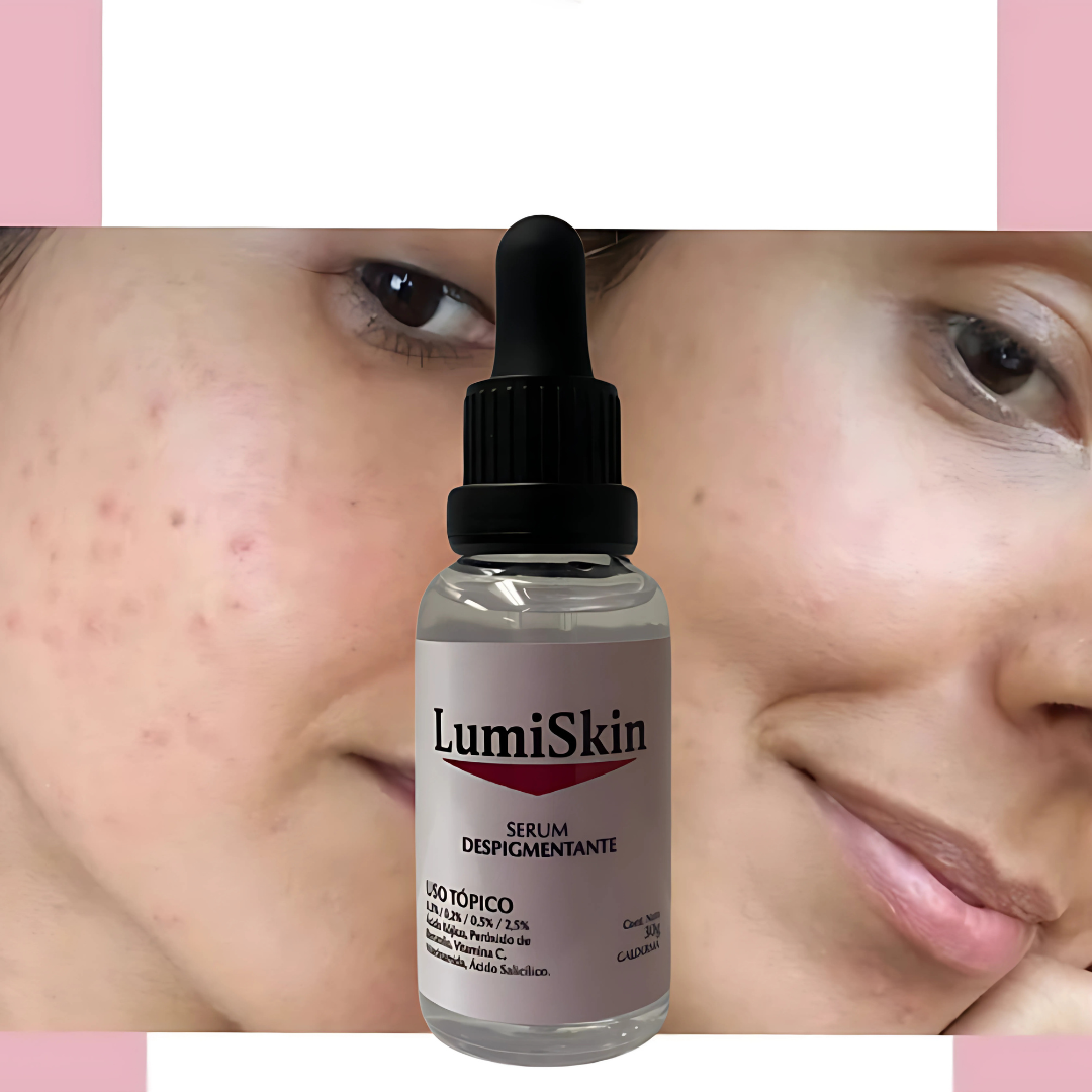 LumiSkin® Serum Despigmentante